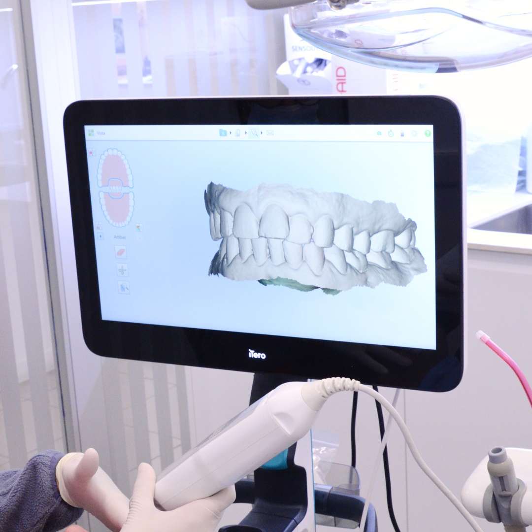 escaner intraoral clinica dental doctoras gandia