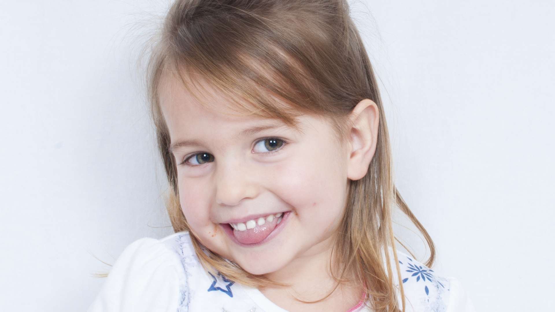 clinica dental doctoras gandia frenectomía